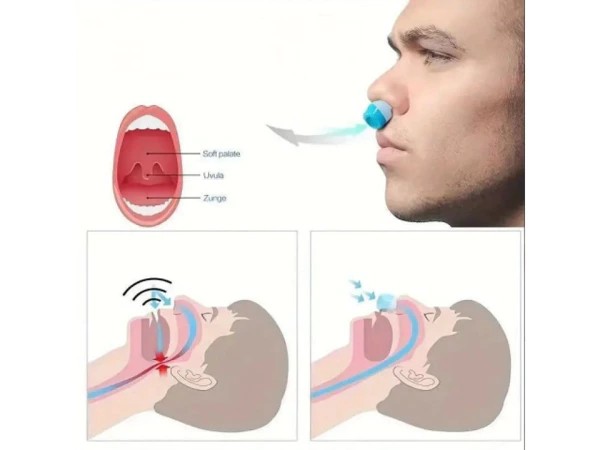 Insert nasal anti-ronflement